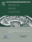 Quantifying the uncertainty in model parameters using Gaussian process-based Markov chain Monte Carlo in cardiac electrophysiology