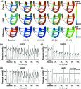 Computational analysis of the effect of mitral and aortic regurgitation on the function of ventricular assist devices using 3D cardiac electromechanical model