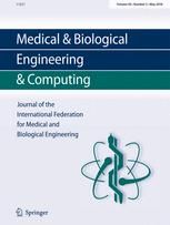 Influence of LVAD function on mechanical unloading and electromechanical delay: a simulation study
