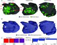 Termination of re-entrant atrial tachycardia via optogenetic stimulation with optimized spatial targeting: insights from computational models